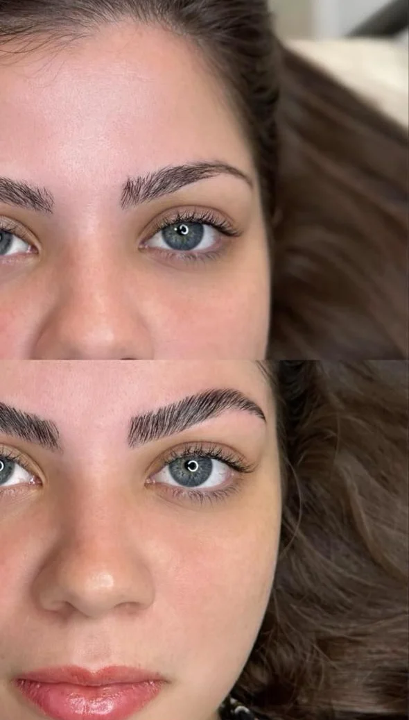 Sobrancelhas antes e depois